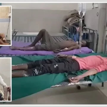 હાલોલ GIDCમાં એગ્રો ફેક્ટરીમાં ગંભીર દુર્ઘટના: 5 શ્રમિકો દાઝ્યા